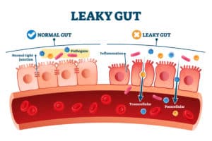 10 Best Gut Healing Foods (Heal Leaky Gut in 2 Weeks)