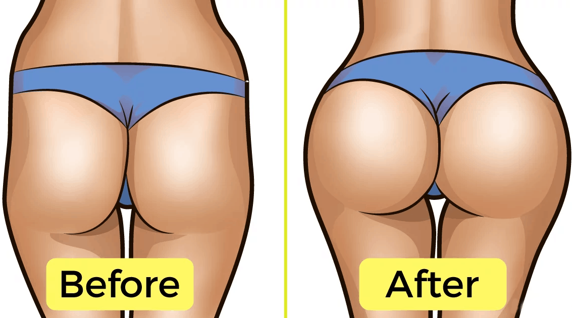 get rid of hip dips before and after