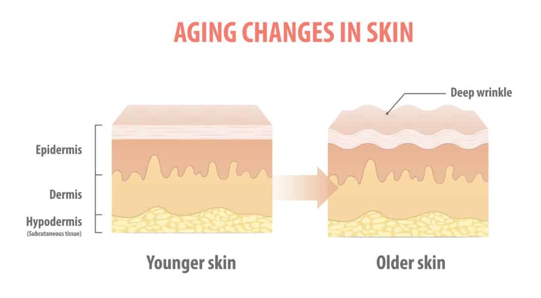 increase collagen skin aging changes