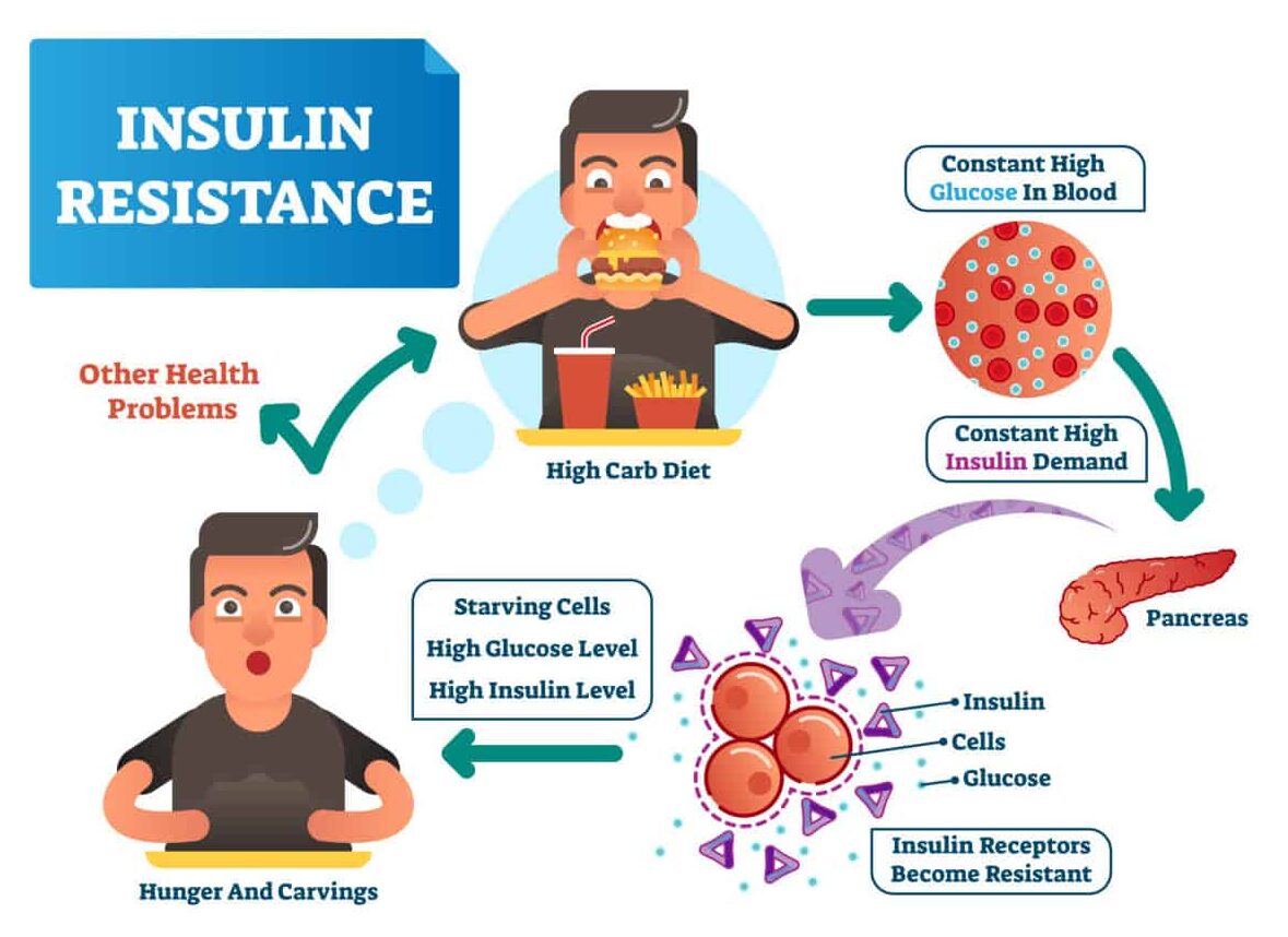 insulin resistance