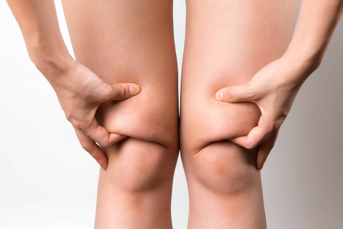 how to get rid of knee fat