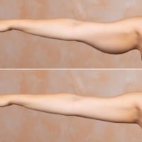 how to lose fat from arms
