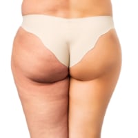 get rid of cellulite on your butt