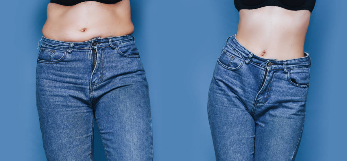 How to Get Rid of a Skinny Fat Belly (Workout Plan)