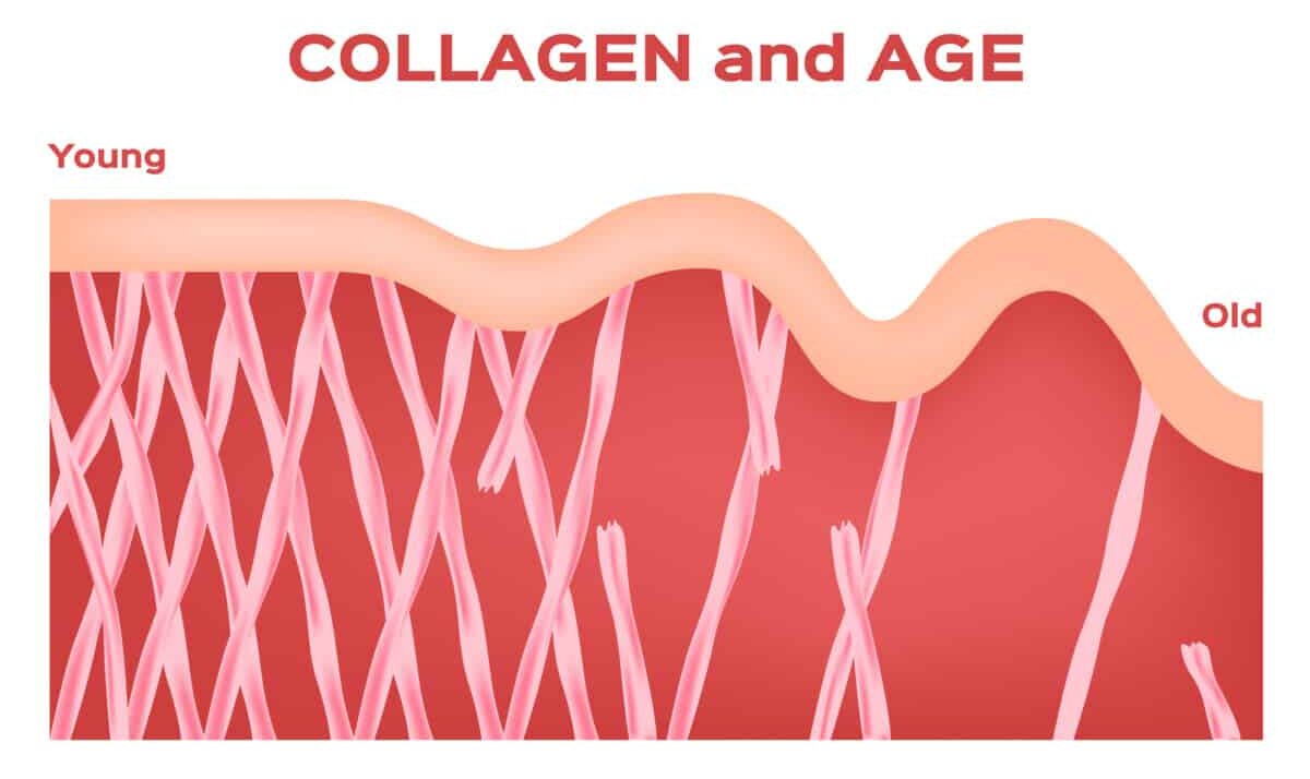 collagen skin aging