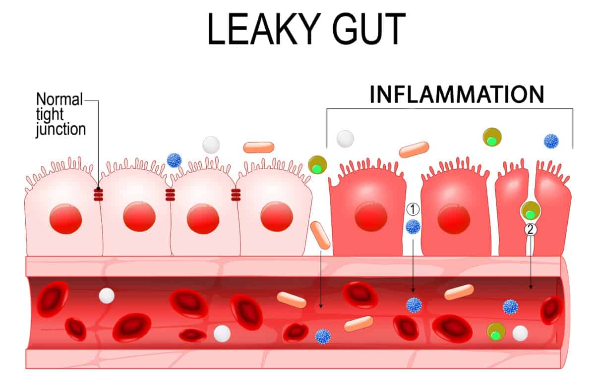 leaky gut weight gain