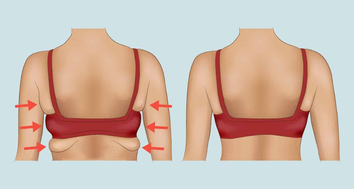 armpit fat before and after exercise