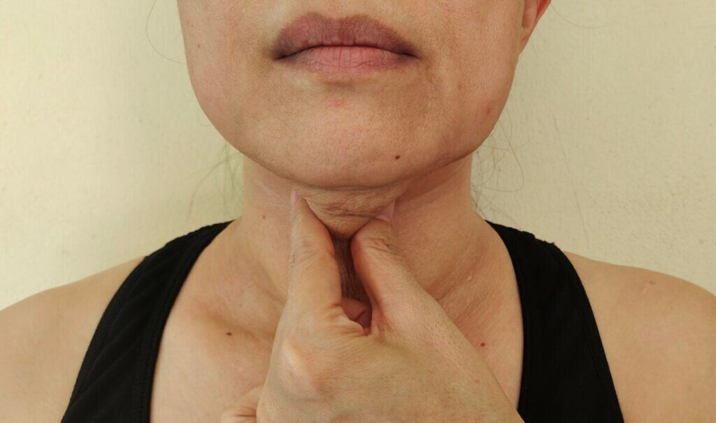 woman pinching turkey neck fat woman pinching turkey neck fat